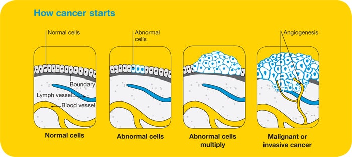 How cancer starts diagram