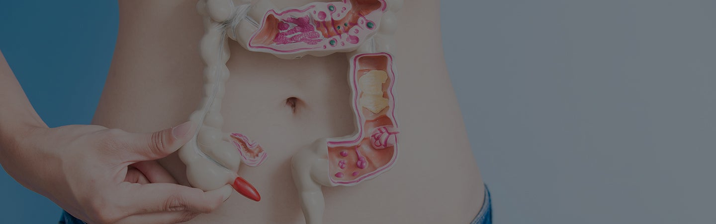 Gut Health Analysis Intestinal Profile