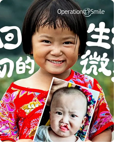 Case study card image