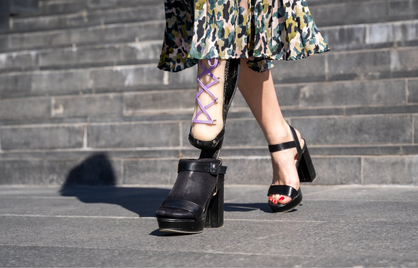 
Mid shot of a woman's legs, she is in mid-stride. Her right leg is prosthetic. 