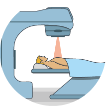 An illustration of a man lying under the radiation machine getting radiation therapy.