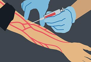 Illustration of person's arm and veins receiving blood test.