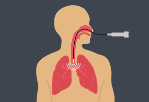 Illustration of person showing a tube going to lungs.
