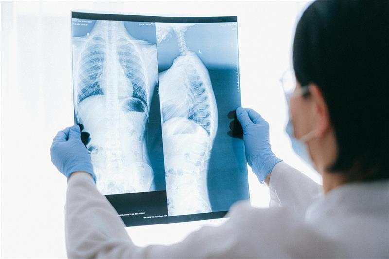 A guide to: lung cancer screening