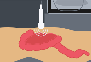 Illustration of ultrasound scan.