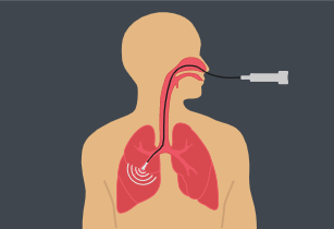 Illustration of tool passing through oesophagus into right lung.