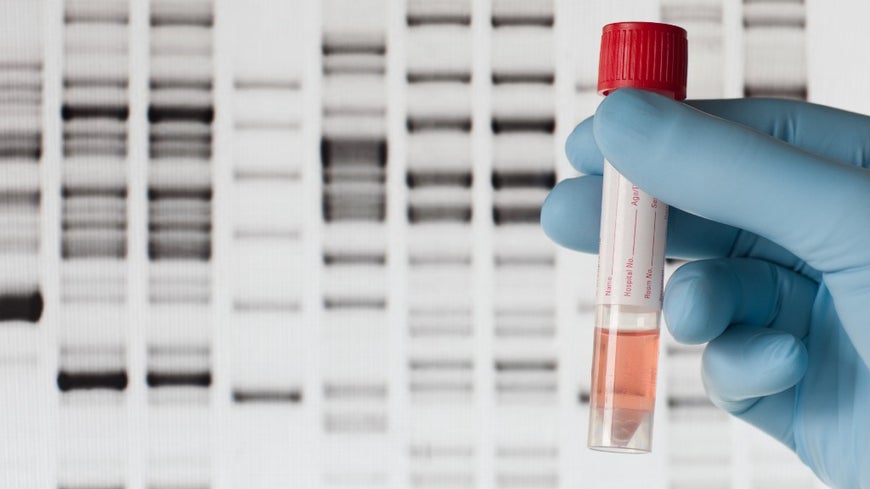 A hand with a blue medical gloves is holding a medical sample in front of a computer screen with the results of a DNA test. 