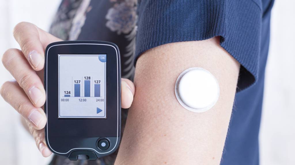 Close-up of a hand of a woman showing a reader after scanning the glucose monitoring system on her arm.