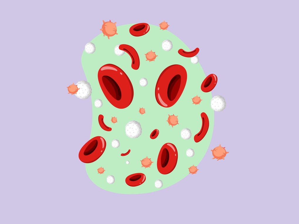 Sickle Cells Sickle Cells