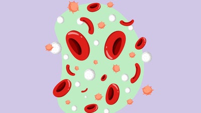 Sickle Cells 