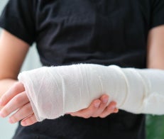 ASsessing care with a cast on arm