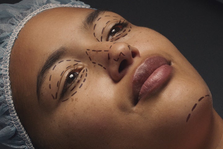 Woman with a hair cover and markings on her face before cosmetic procedure